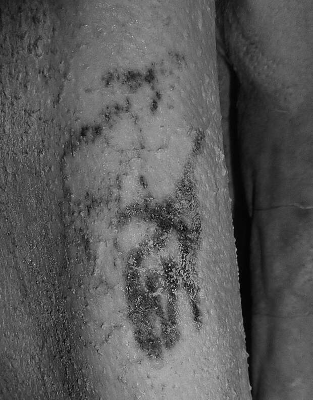 Detail of the tattoos observed on the male mummy's right arm under infrared light.