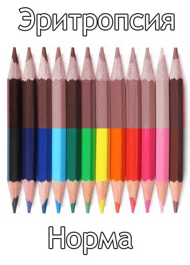 эритропсия