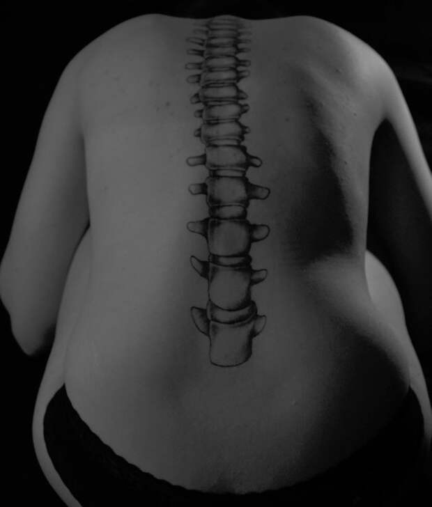 A Straight Spine In Celebration Of Overcoming Scoliosis