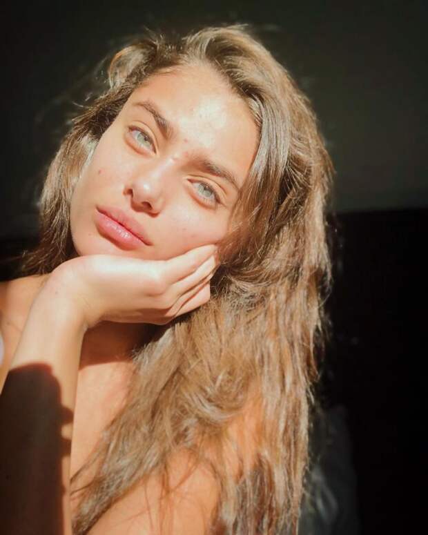 Не надо стесняться! Ангел Victoria's Secret показывает свое лицо с акне