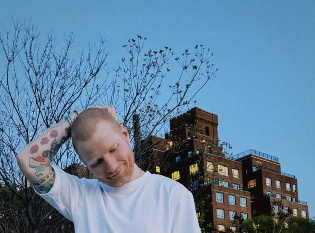 Певец Эд Ширан признался, что побрил голову на фоне борьбы с опоясывающим лишаем