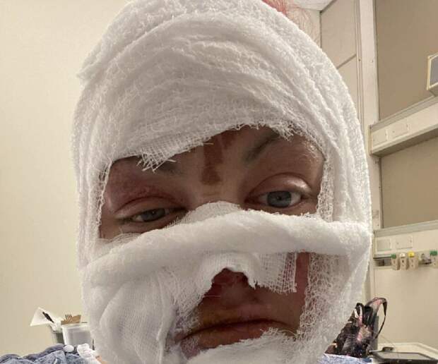 Daily Mail: американка получила ожоги лица, ремонтируя автомобиль