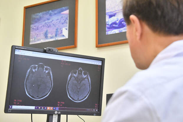 Neurology: перенесенная инфекция повышает риск инсульта у детей в два раза