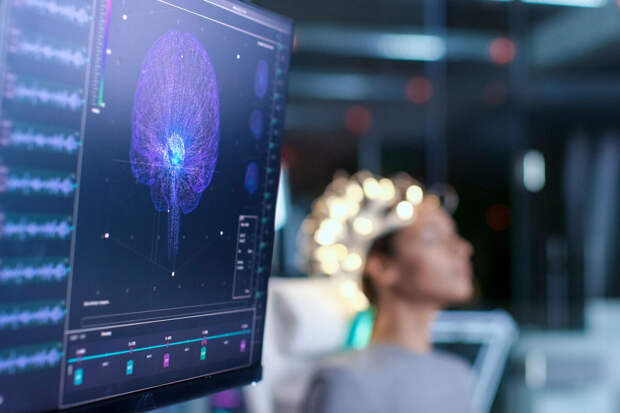 Radiology: низкоинтенсивная светотерапия ускоряет регенерацию нейронных связей