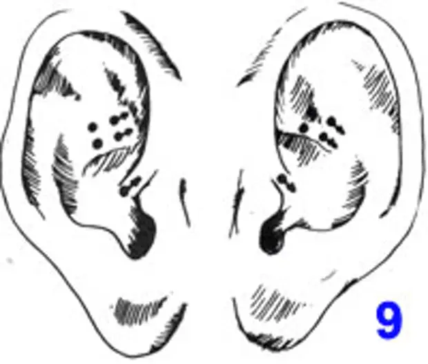 Козелковый массаж уха