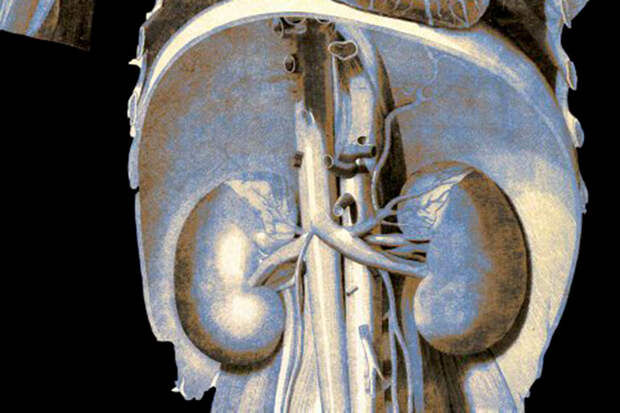 BMC: пародонтит и гингивит усиливают повреждение почек