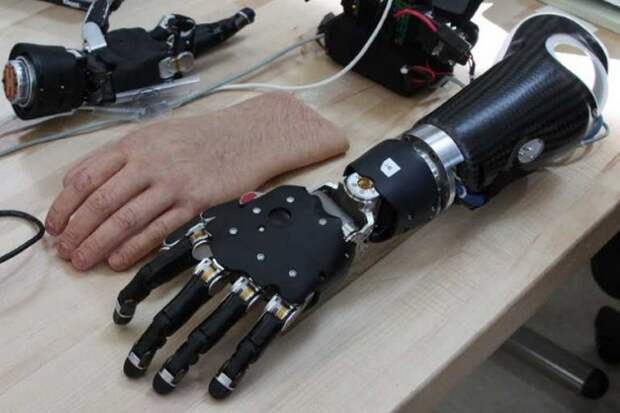 Умные протезы