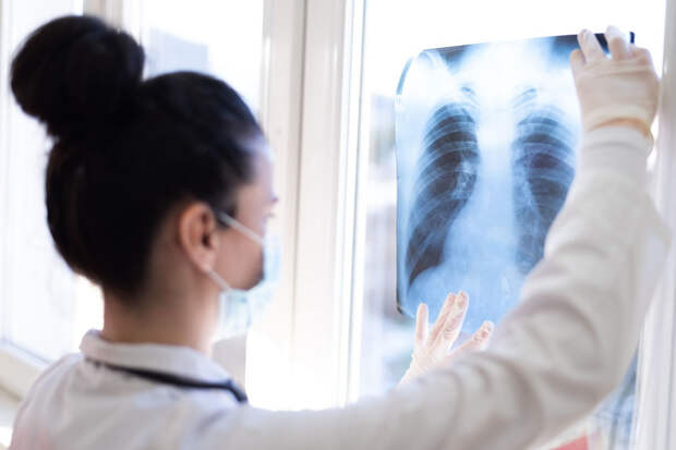Почему никогда не курившие пациенты с раком легких имеют гораздо худшие результаты выживаемости?