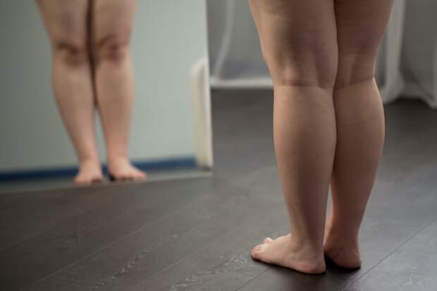 Женщина похудела на 63 килограмма и приняла радикальное решение о личной жизни