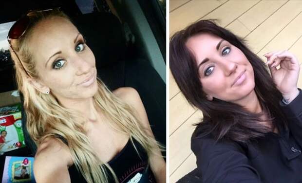 Преображения бывших наркоманов (21 фото)