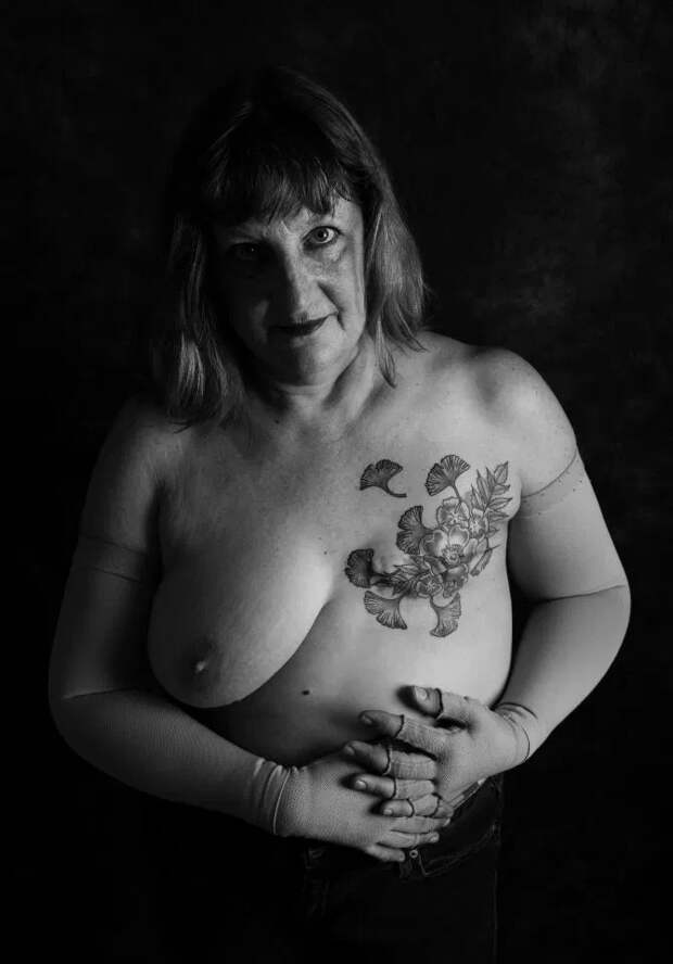 Голая правда: смелые пациенты противостоят раку, демонстрируя шрамы в пронзительном фотопроекте Ами Барвелл