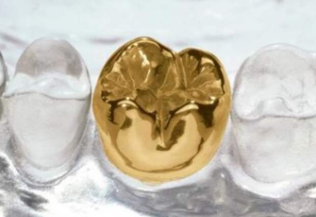 В Древнем Риме из металла изготавливали зубные мосты, а позже начали вставлять золотые зубы / Фото: panram.ru