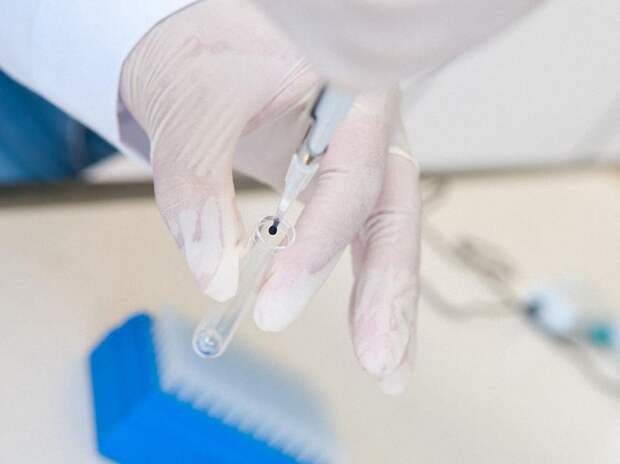 flu10 Все, что нужно знать о вирусе гриппа