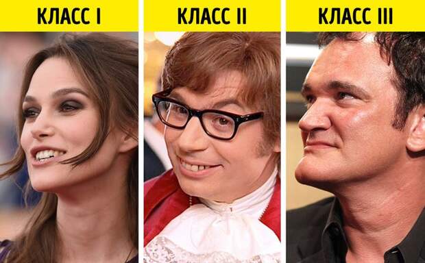 Как неправильный прикус влияет на самочувствие и внешность