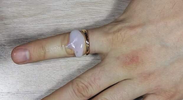 Кольцо с пальца поможет снять вазелин. / Фото: willcomfort.ru