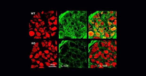 Моноциты помогают мужчинам быстрее справляться с болью после травмы