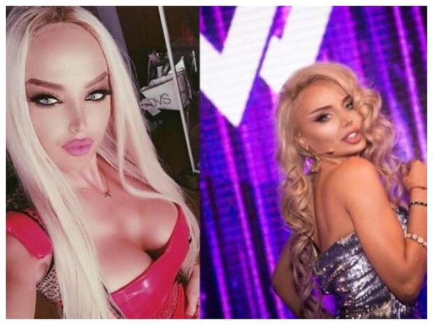 2 миллиона за пластику, покорение