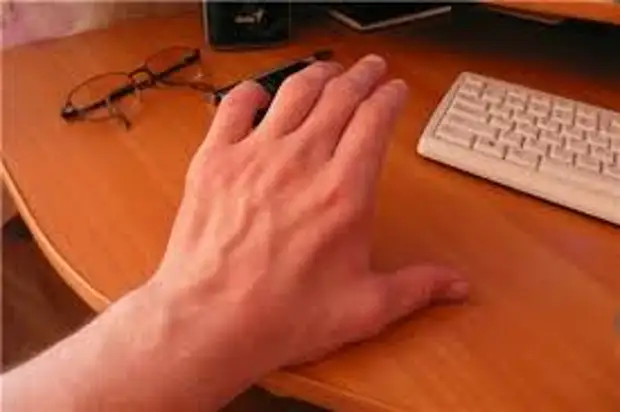 туннельный синдром из за компьютера. болезни кисти от компьютерной мыши. рука от компьютерной мышки. профилактика туннельного синдрома. перегрузка суставов кистей рук.