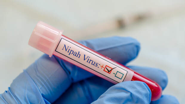 Инфекционист Никифоров заявил, что вирус Нипах не сможет вызвать эпидемию