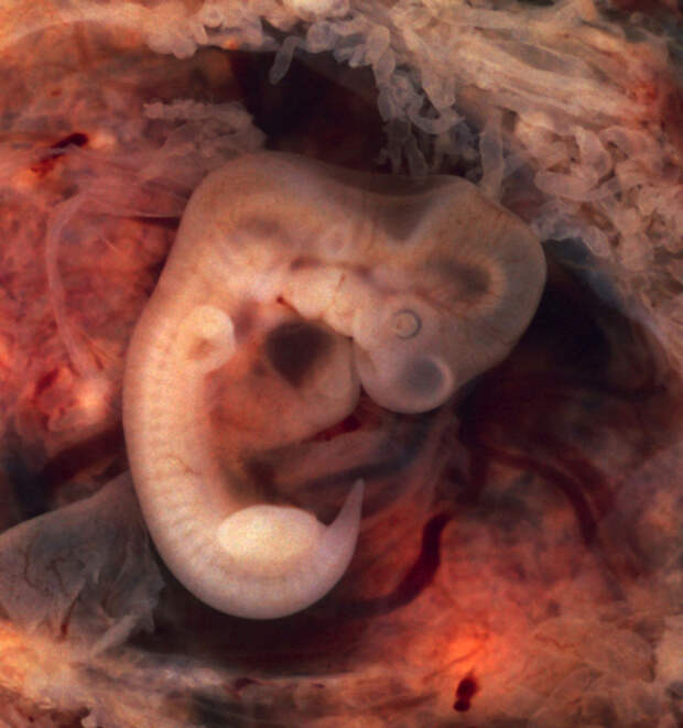 Как серотонин влияет на развитие эмбрионов