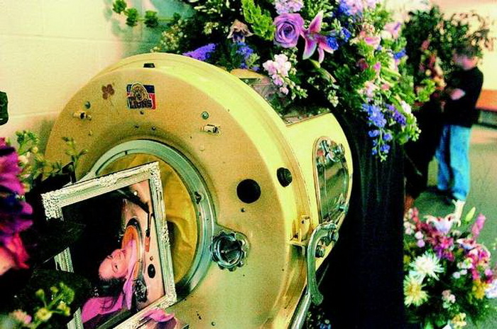 Диана Оделл - женщина, которая почти 60 лет провела с железными легкими