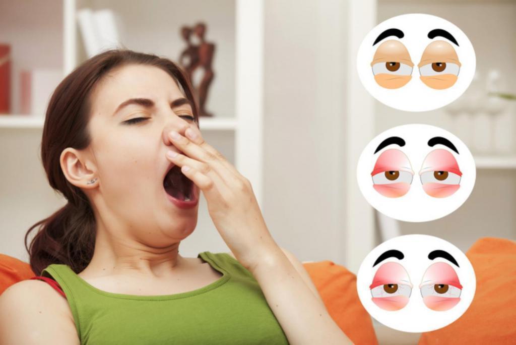 Что делать, если у вас чувствительные глаза? 10 советов, которые помогут