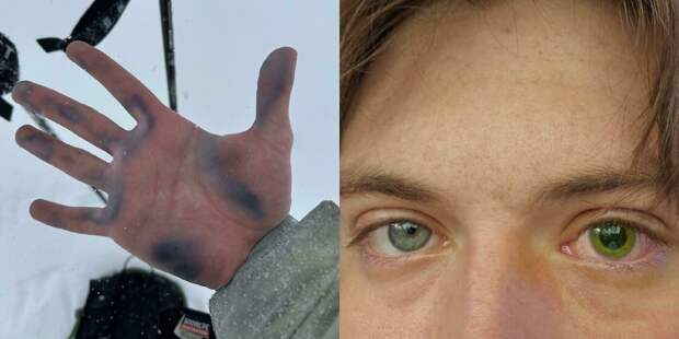 Тело человека: 22 фото состояний, которые трудно представить