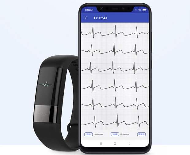 Huami Amazfit — портативный электрокардиограф от Xiaomi (6 фото)