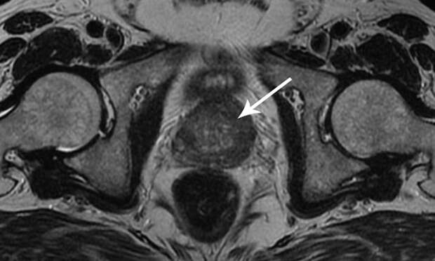 Диагностика онкологических заболеваний в МДЦ «Рэмси Диагностика»