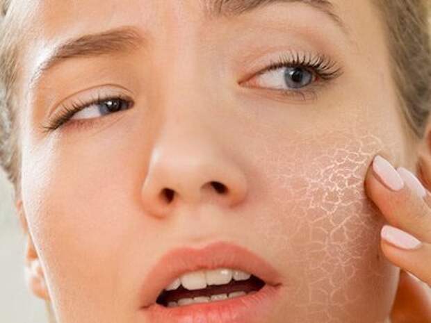6 признаков дефицита кальция, которые нельзя игнорировать!1