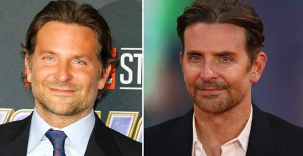 51-летний Брэдли Купер прокомментировал слухи о пластической операции