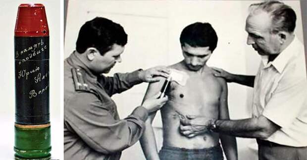 Как советские хирурги разминировали живого человека