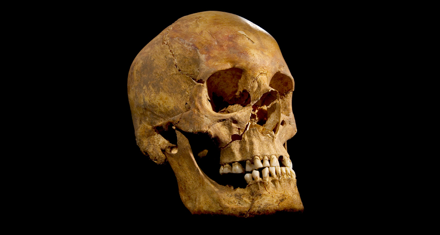 The discovery of King Richard III’s bones, including the skull shown here, enabled scientists to determine that his diet changed dramatically around the time he ascended to the throne.