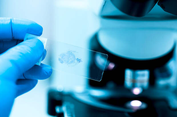 AdvSci: агрессивные раковые опухоли могут разрастаться за счет жиров