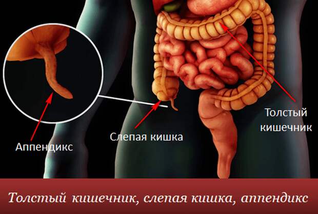 Аппендицит. Симптомы у взрослых