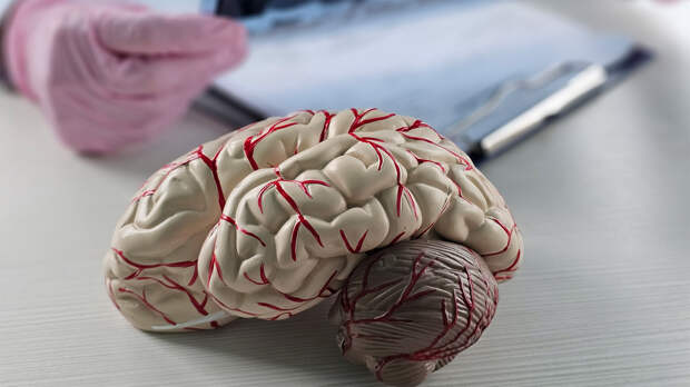 Редкий диагноз меняет речь на иностранную — как страдает мозг