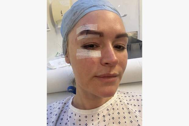 Известная телеведущая рассказала о неуверенности в себе из-за шрамов на лице