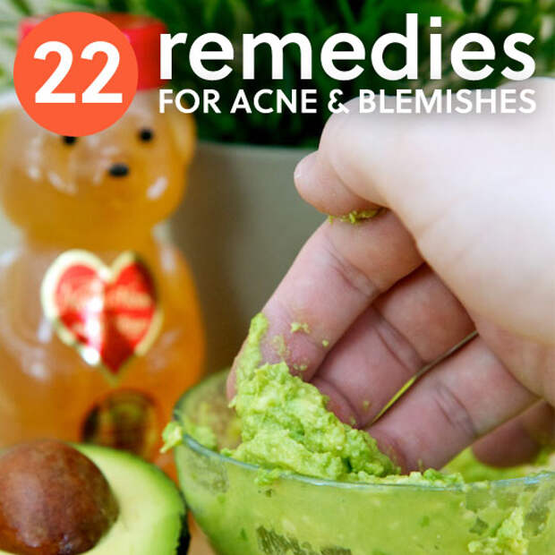22 Acne Remedies- to make your skin glow.