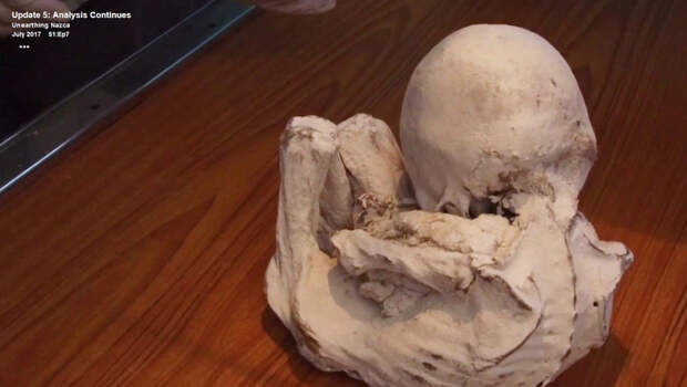 Ученые изучают пятую из "инопланетных" мумий Наска, скорченную в позе младенца