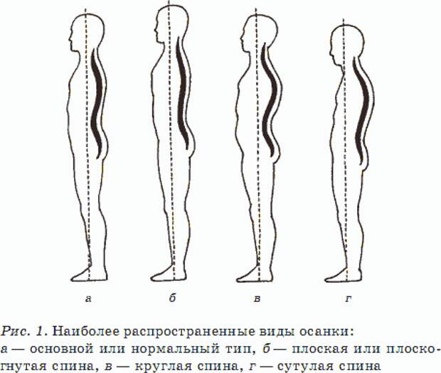 Рассмотрите рисунки 1 4 с изображением типов осанок человека как называется