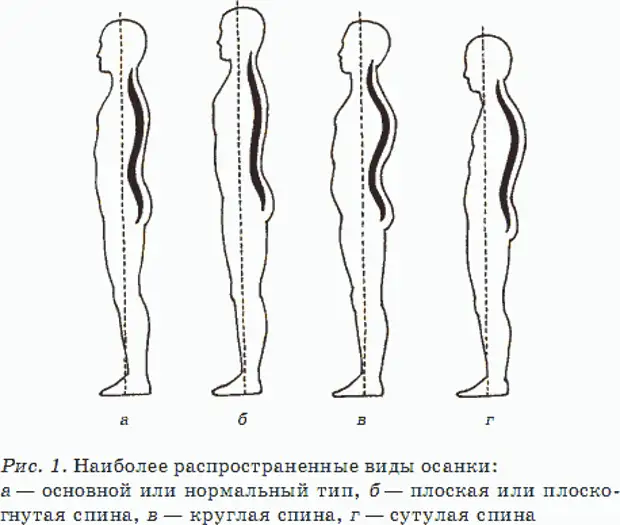 Как должна выглядеть нормальная. Нормальная форма позвоночника вид сбоку. Лордоз кифоз плоская спина. Типы осанки по штаффелю. Нормальное положение позвоночника сбоку.