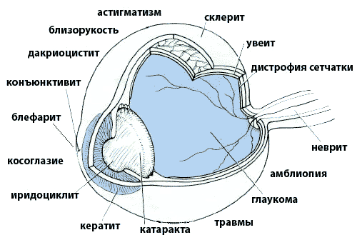 Патология глаз это. Мидриаз, экзофтальм птоз. Патология глаз это. Патология глаз это. Нарушение зрения косоглазие.